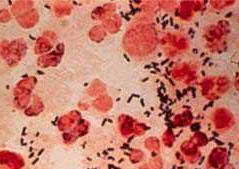 SIM: Neisseria gonorrhoeae 2011